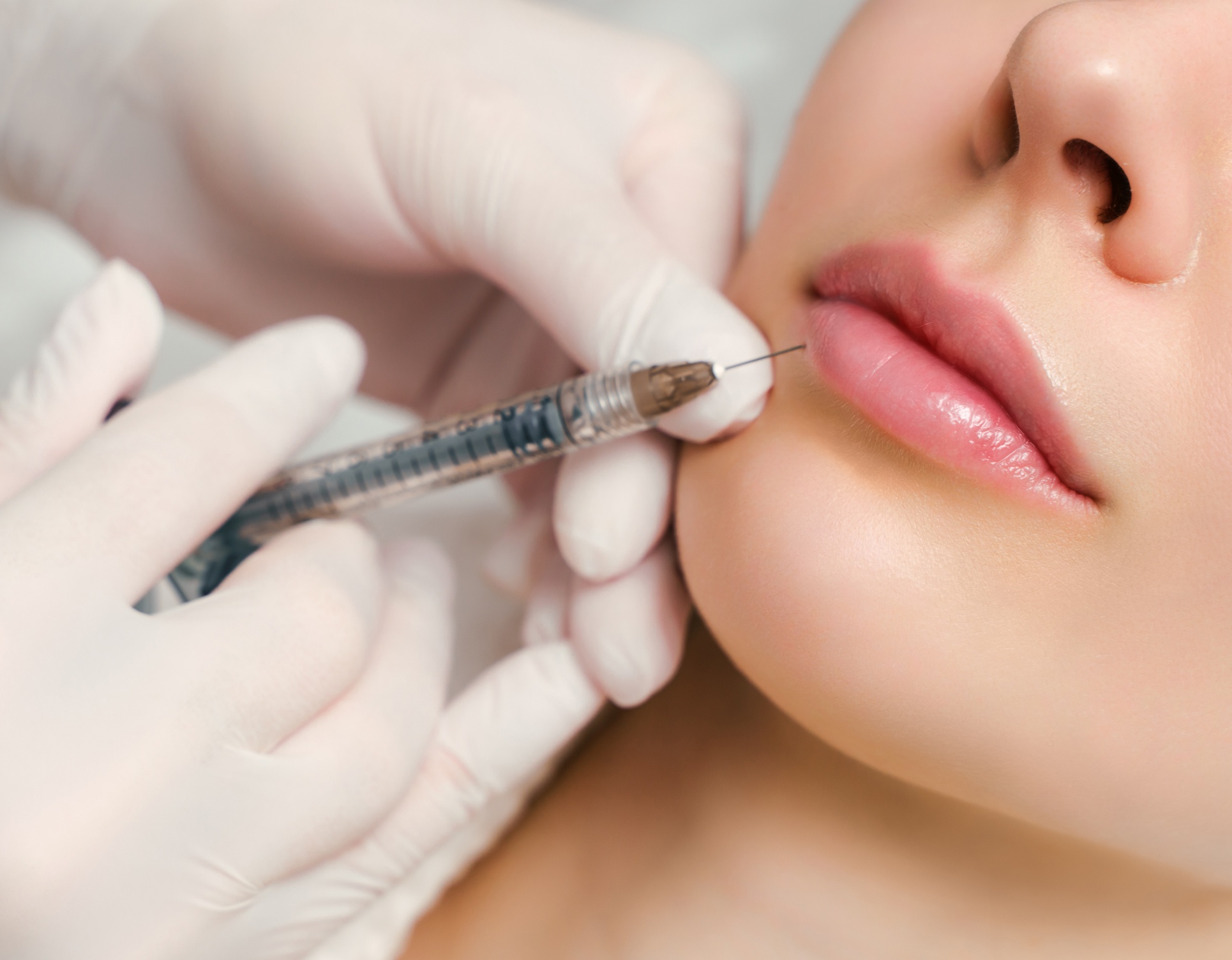 Une injection dans les levres d une jeune femme acide hyaluronique | Dr Barbera Paris