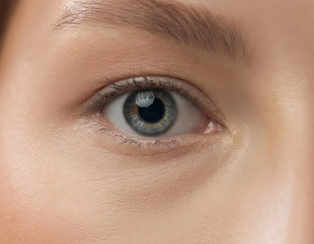 Vue rapprochee sur l oeil d une jeune femme Cernes | Dr Barbera Paris