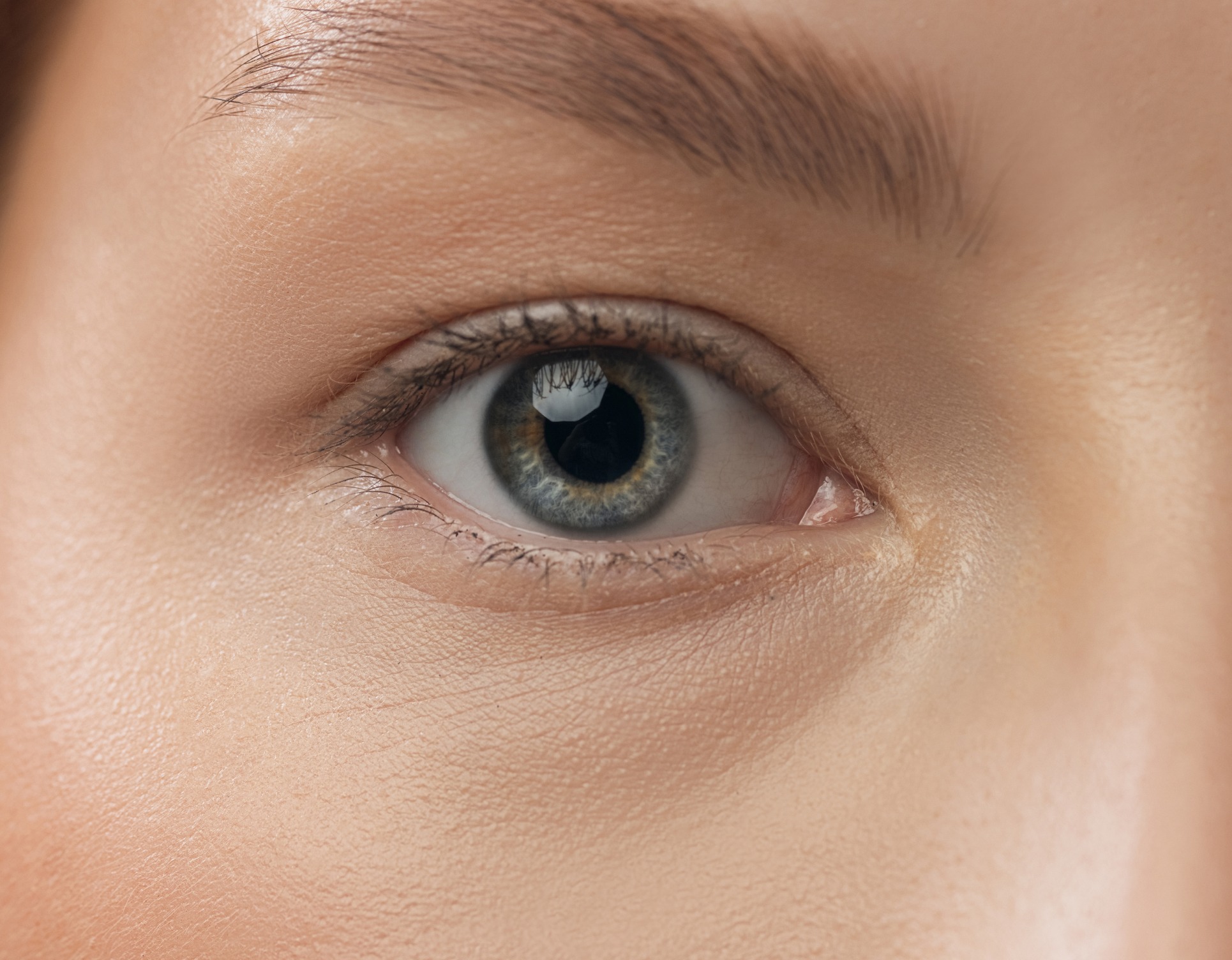 Vue rapprochee sur l oeil d une jeune femme Cernes | Dr Barbera Paris