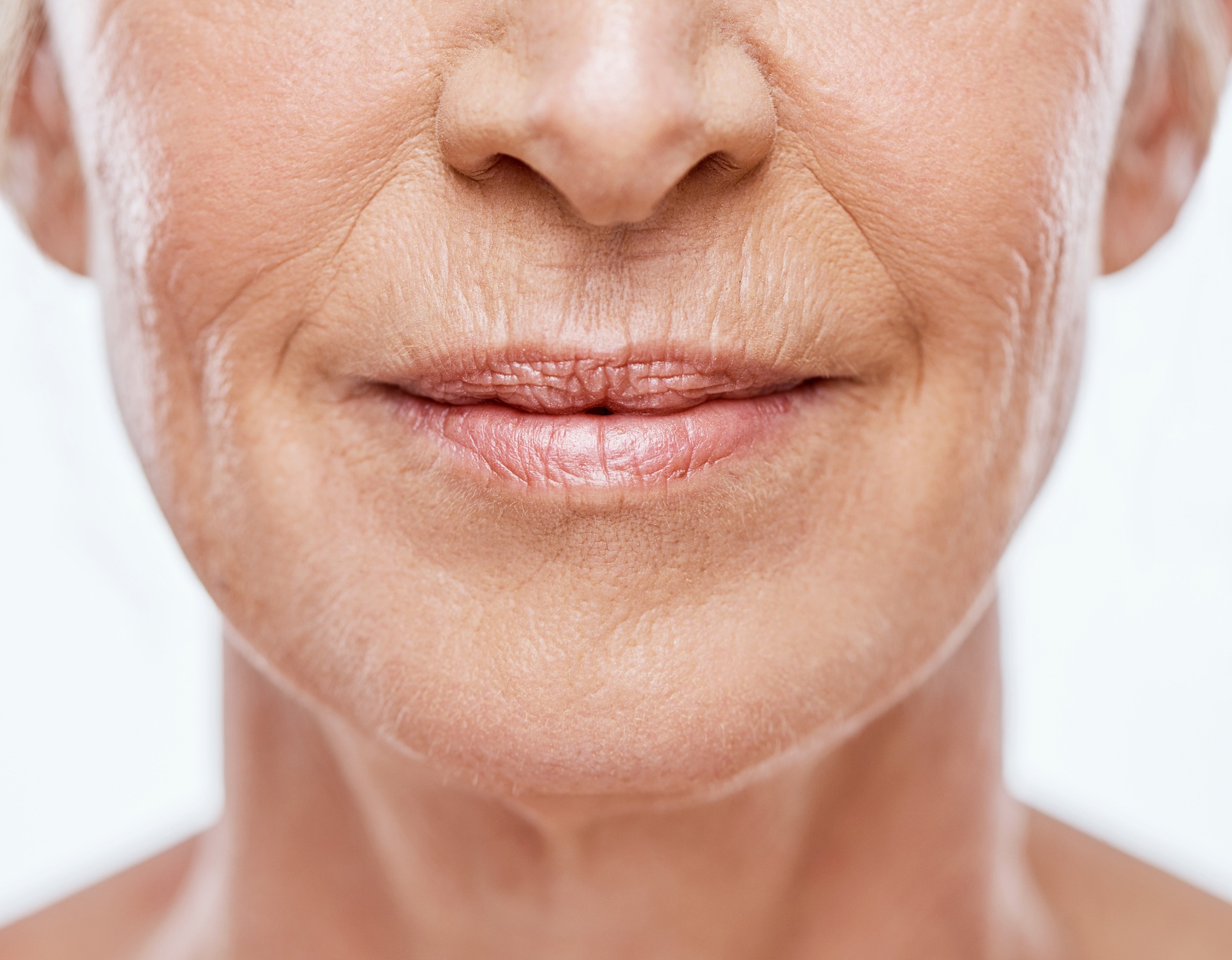 Bouche et nez d une femme agee avec beaucoup de rides lifting des levres lip lift | Dr Barbera Paris