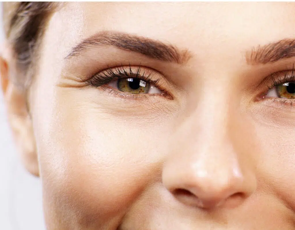 Vue rapprochee sur le nez et l oeil d une femme Ride de la patte d oie | Dr Barbera Paris