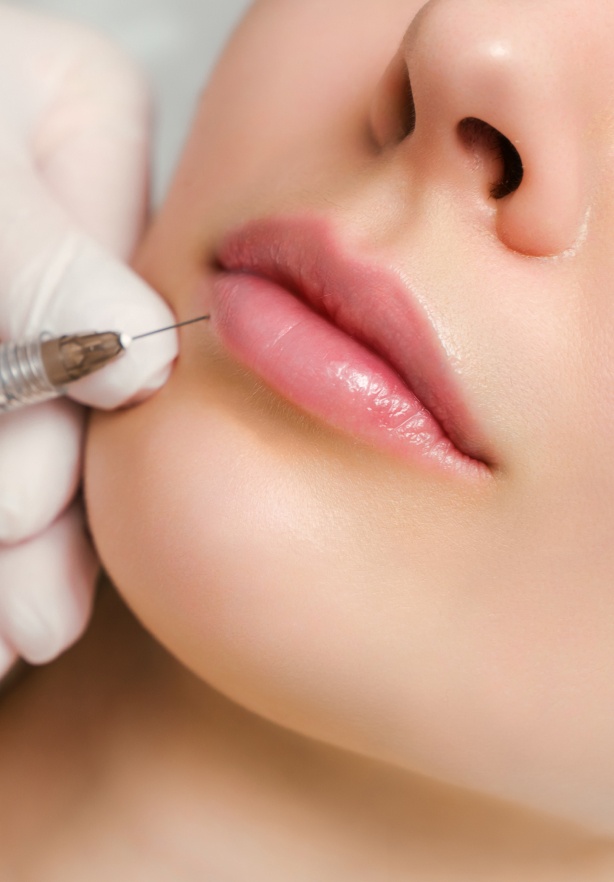 Une injection dans les levres d une jeune femme acide hyaluronique | Dr Barbera Paris