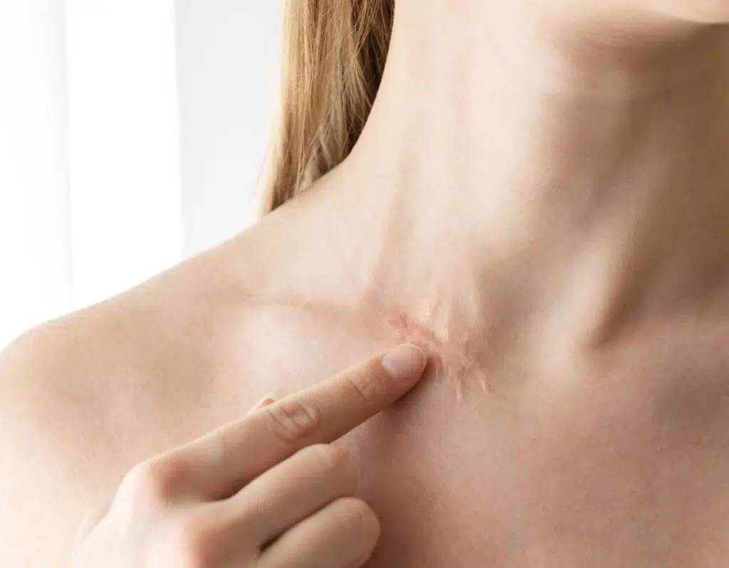 Laser Urgo Touch | Chirurgie dermatologique | Dr Barbera | Paris 16
