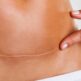 Le Laser UrgoTouch pour estomper les cicatrices chirurgicales
