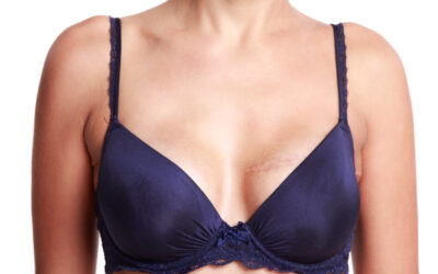 Reconstruction mammaire | Dr Barbera | Paris 16